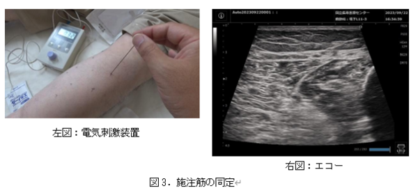 図3. 施注筋の同定。左図:電気刺激装置画像。右図:エコー画像。