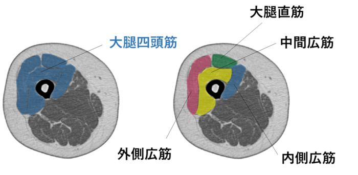 図１