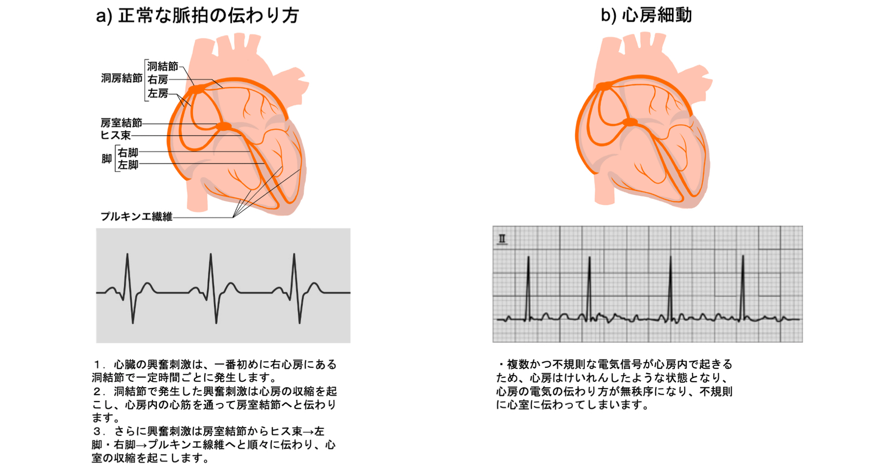 脈の乱れとは – 脈の乱れ 原因 – MUWDNE