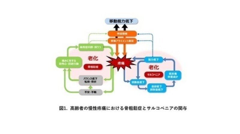 図1高齢者の慢性疼痛における骨粗鬆症とサルコペニアの関与