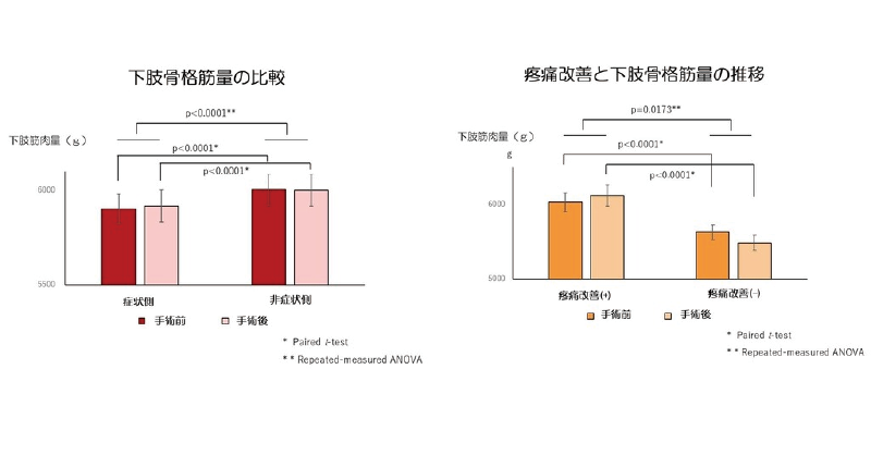 高齢者の神経障害性疼痛はサルコペニアと関連があることを明らかにしま