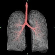 Lung3DCT