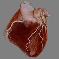 Cardiac3DCT