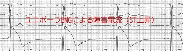 COIの観察