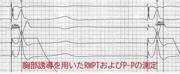 各種パラメーターの計測