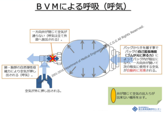 バックバルブ換気（呼気）の仕組みの図解