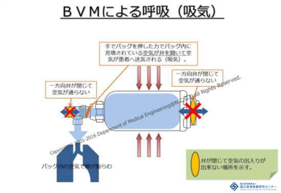 バックバルブ換気（吸気）の仕組みの図解