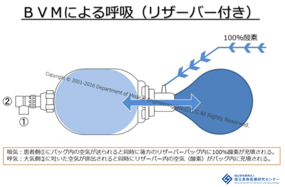 リザーバーバッグを取り付けて行う用手換気