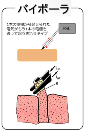 バイポーラ出力のイメージ図