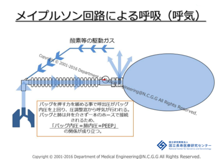 ジャクソンリース回路による呼気制御の図