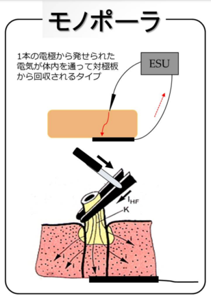 モノポーラ出力のイメージ図