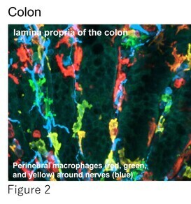 Figure 2. Colon-NAMs