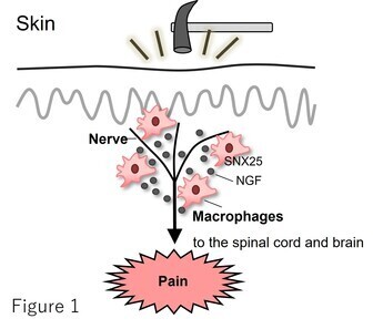 Figure 1. skin-snx25