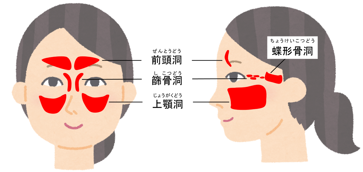 図1、副鼻腔4つの位置を顔を正面から見た図と横から見た図で示す。
