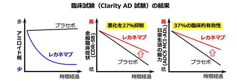 レカネマブの臨床試験では，プラセボと比較して，アミロイド班の顕著な減少と，CDR-SBという指標で評価する全般臨床症状の悪化の抑制が認められた。また， ADCS MCI-ADLという指標で評価する自立して生活する能力についても，プラセボと比べて37％の臨床的有効性が認められた。