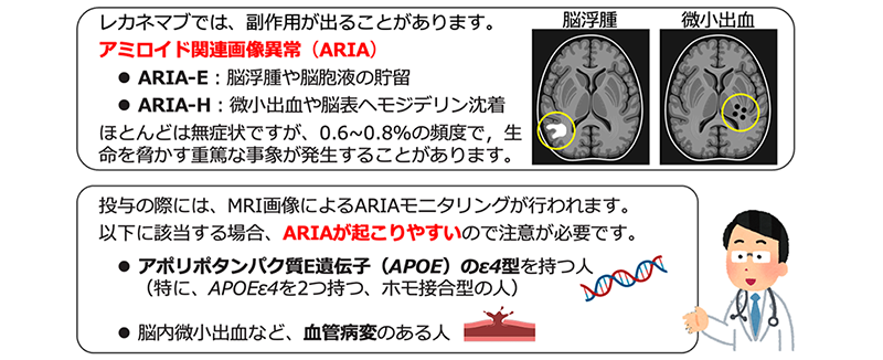 レカネマブの投与による副作用に，アミロイド関連画像異常（ARIA）がある。ARIAには大きく分けて、脳の血管の周りに水が溜まる浮腫（ARIA-E）と、脳内の微小出血や鉄（ヘモジデリン）沈着（ARIA-H）の２種類がある。ほとんどの場合は，無症状だが，0.6-0.8%の頻度で，生命を脅かす重篤な事象が発生することがある。また，アポリポタンパク質E遺伝子のイプシロン4型を有する人，血管病変のある人に副作用が起こりやすいことが知られている。