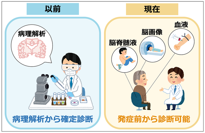 アルツハイマー病の診断を確定するために，以前は患者さんの死後に脳の病理解析を行い、アルツハイマー病に特徴的な脳の病変があることを確認する必要がありました。現在は，脳画像や脳脊髄液，血液の検査で生前にアルツハイマー病を正確に診断する方法が開発されています。