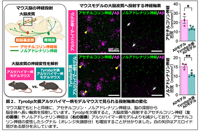 図2。Tyrobp欠損アルツハイマー病モデルマウスで見られる投射軸索の変化 マウス脳でもヒトと同様に、アセチルコリン・ノルアドレナリン神経は、脳の深部から 脳全体へ長い軸索を投射しています。Tyrobpを欠損すると,大脳皮質へ投射するアセチルコリン神経やノルアドレナリン神経はアルツハイマー病モデルよりも減少しており、アセチルコリン神経の変性したシグナルも増加することが分かりました。