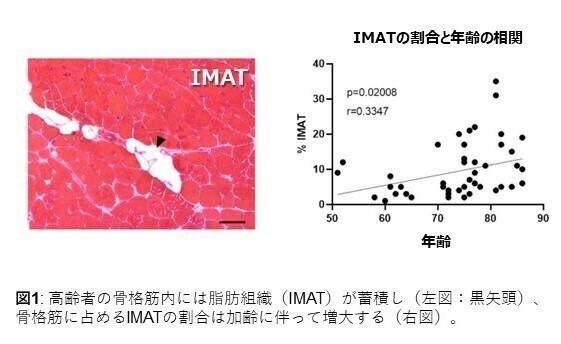 図１：高齢者の骨格筋内には脂肪組織が蓄積し、その割合は加齢に伴って増加する。