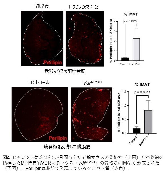 図４：ビタミンD欠乏食を与えたマウスの骨格筋には脂肪蓄積が見られる。