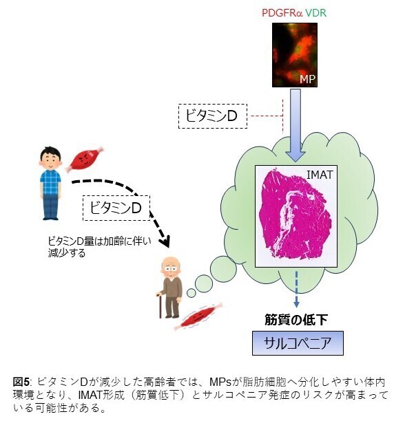 図５：ビタミンDが減少した高齢者では骨格筋内に脂肪が蓄積し易くなり、サルコペニア発症リスクが高まっている可能性がある。