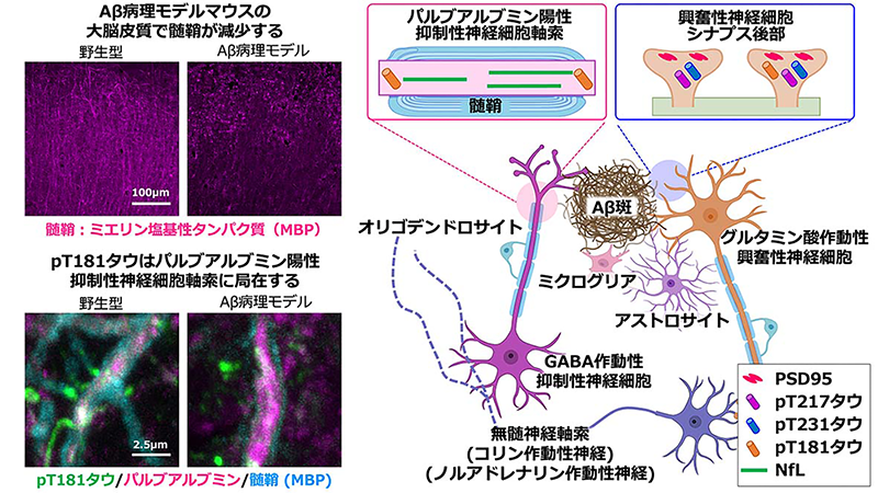 リン酸化タウタンパク質の脳内局在