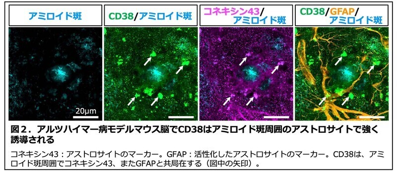 アルツハイマー病モデルマウス脳の免疫染色の画像。アミロイドベータ，C38，コネキシン43，GFAP抗体による染色像。