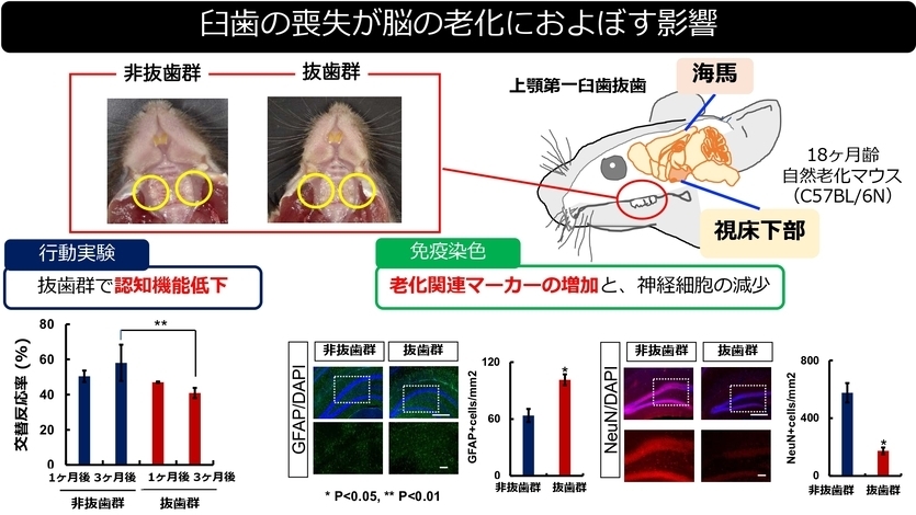 臼歯の喪失が脳の老化におよぼす影響の図