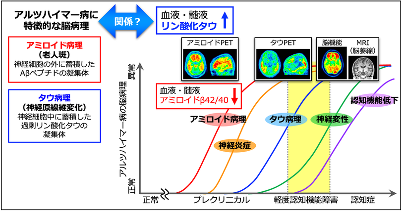 アルツハイマー病の脳病理の変化とバイオマーカーリン酸化タウタンパク質 