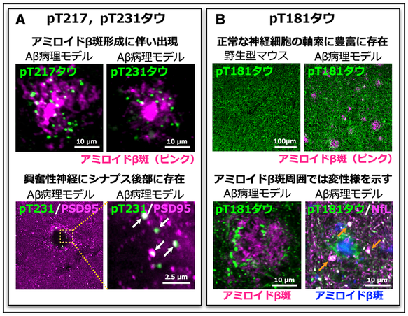 アミロイドベータ病理モデルマウス脳でのバイオマーカーリン酸化タウタンパク質の局在 