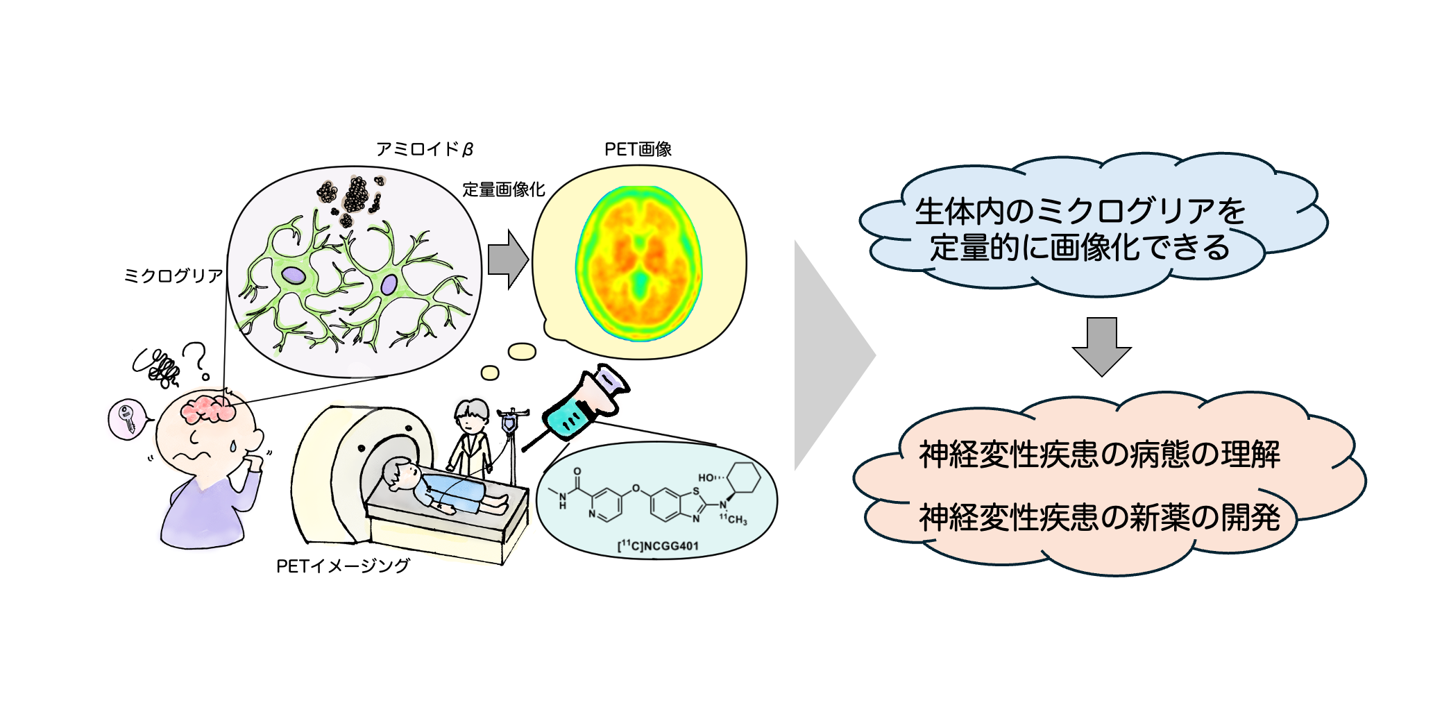 生体内の脳の免疫細胞を捉える新しい臨床イメージング技術を確立